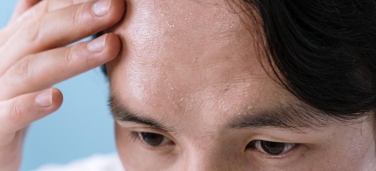 the forehead of a person sweating before fentanyl rehab