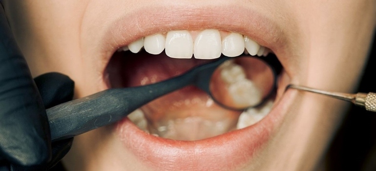 person getting their teeth examined