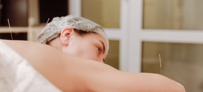 A woman lying down as she receives acupuncture.