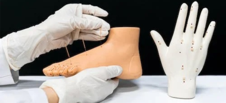 A medical professional explaining how acupuncture in drug addiction treatment works by inserting needles into a plastic foot.
