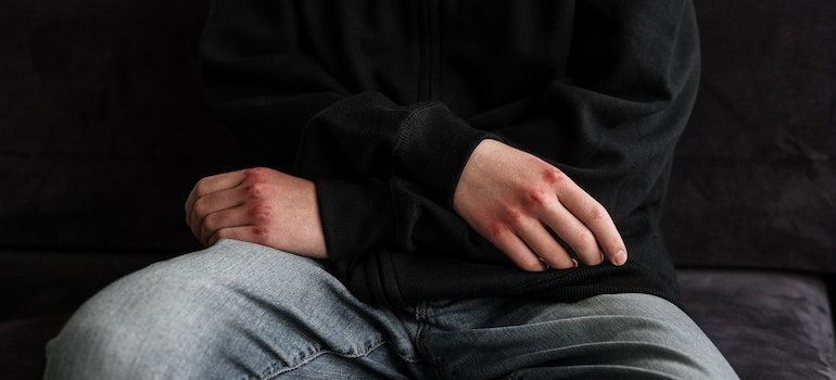 Person with injuries on hands