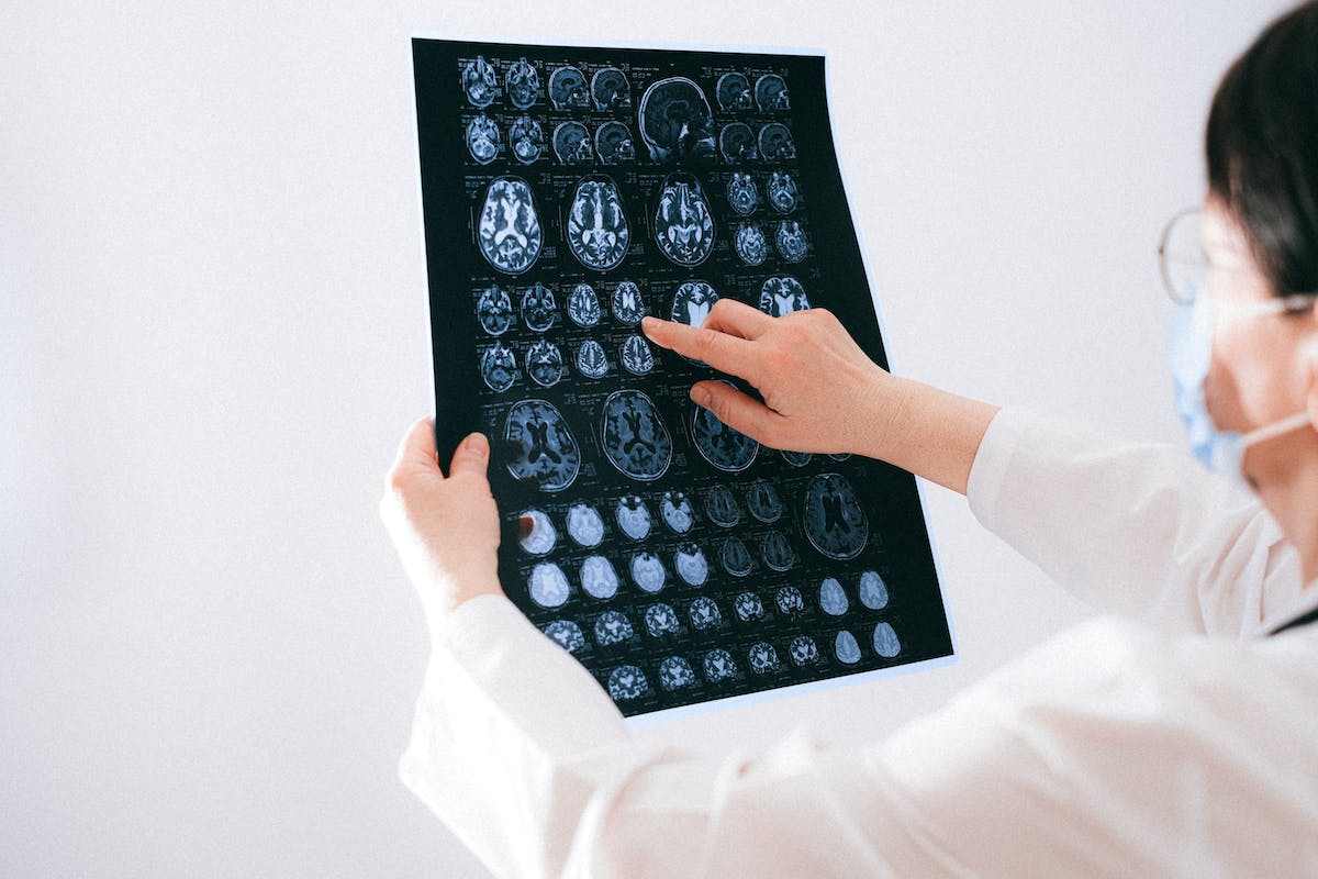 What Is Wet Brain or Wernicke-Korsakoff Syndrome?