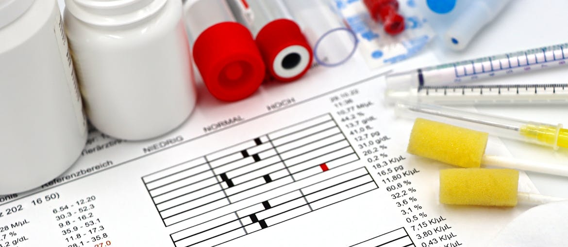 Blood test results.