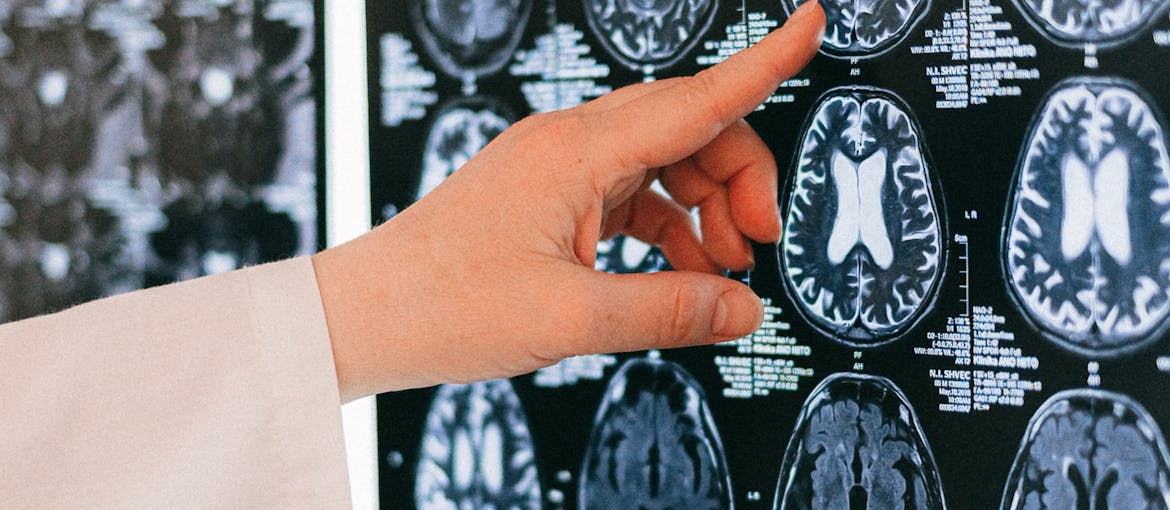 Man pointing to a brain MRI.